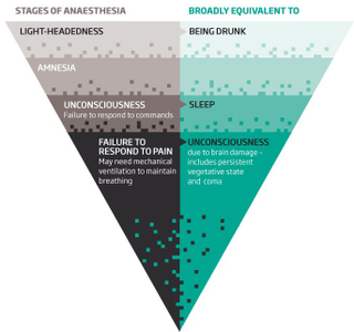 Illustration for article titled Why Anesthesia Is One of the Greatest Medical Mysteries of Our Time